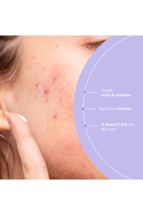 Freshly Cosmetics Azelaic Radiance white