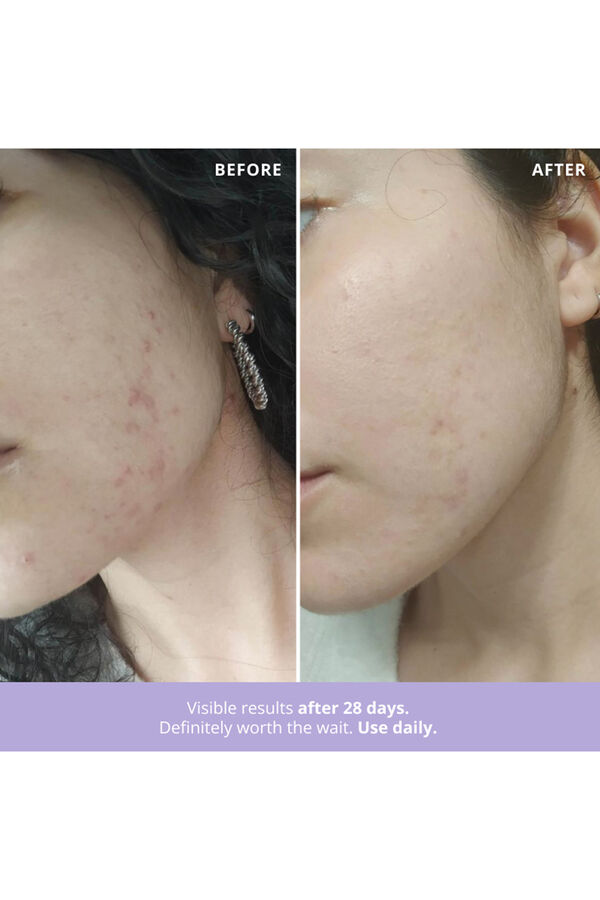 Freshly Cosmetics Azelaic Radiance white